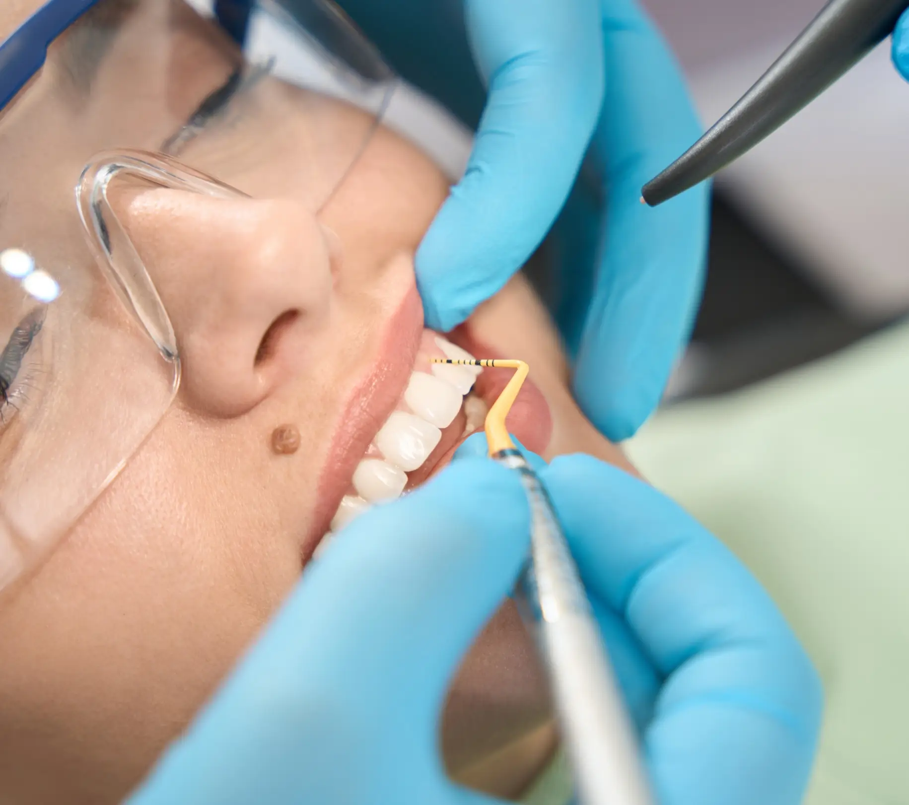 Cosmetic Periodontal