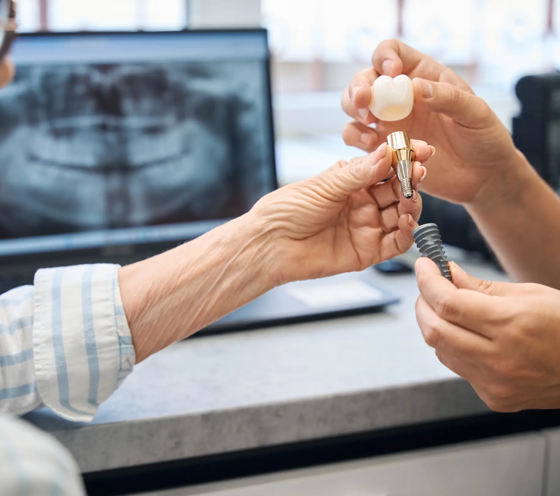 Dentures and Implants