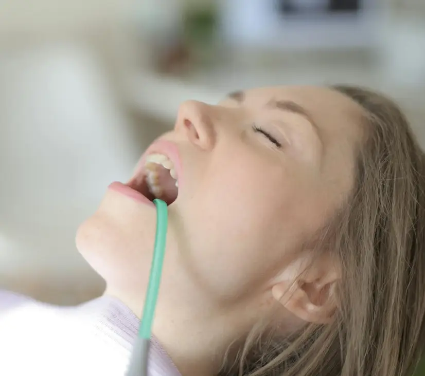 Dental Cleaning Service