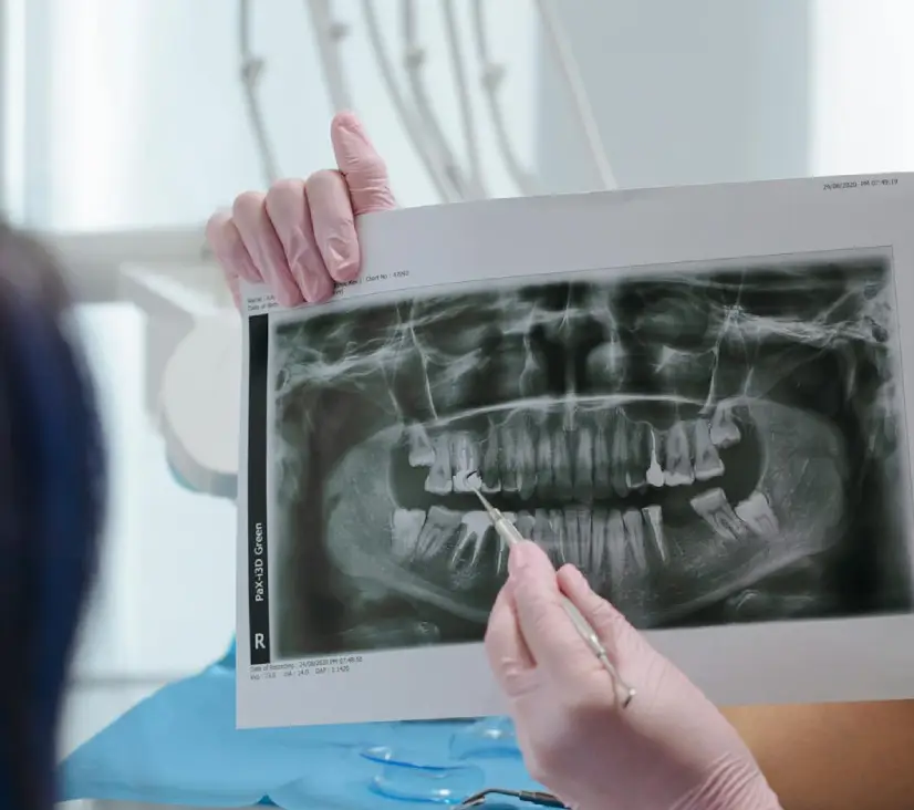 Oral Cancer Screening Treatment