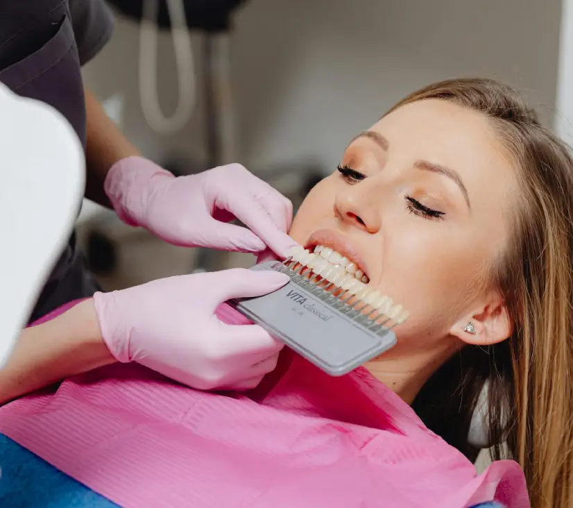 Teeth Bonding and Whitening Treatment