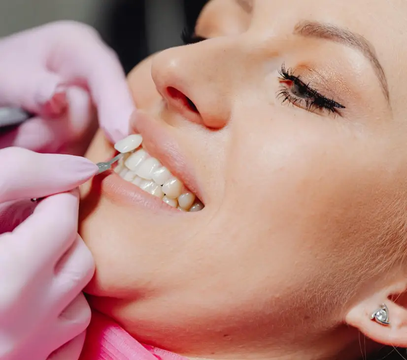 Teeth Whitening